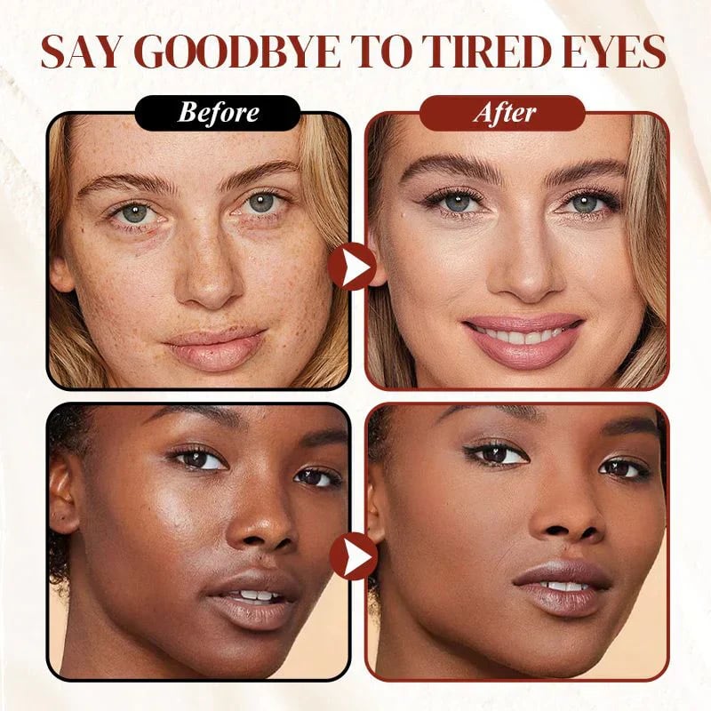 ✨ Historical Sale BUY 1 GET 1 FREE✨Colored Clay Undereye Corrector