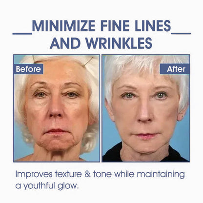 𝐀𝐝𝐯𝐚𝐧𝐜𝐞𝐝 𝐅𝐢𝐫𝐦𝐢𝐧𝐠 & 𝐖𝐫𝐢𝐧𝐤𝐥𝐞-𝐑𝐞𝐝𝐮𝐜𝐢𝐧𝐠 𝐂𝐫𝐞𝐚𝐦