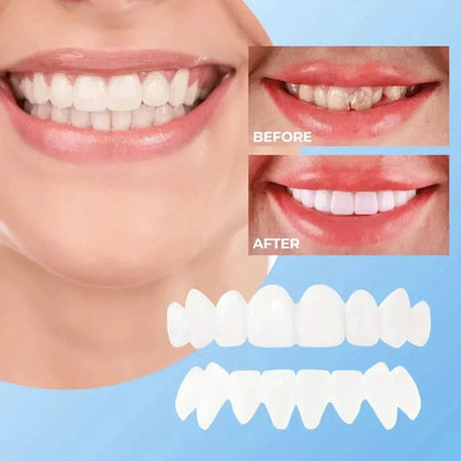 Lonryd SmileFlex