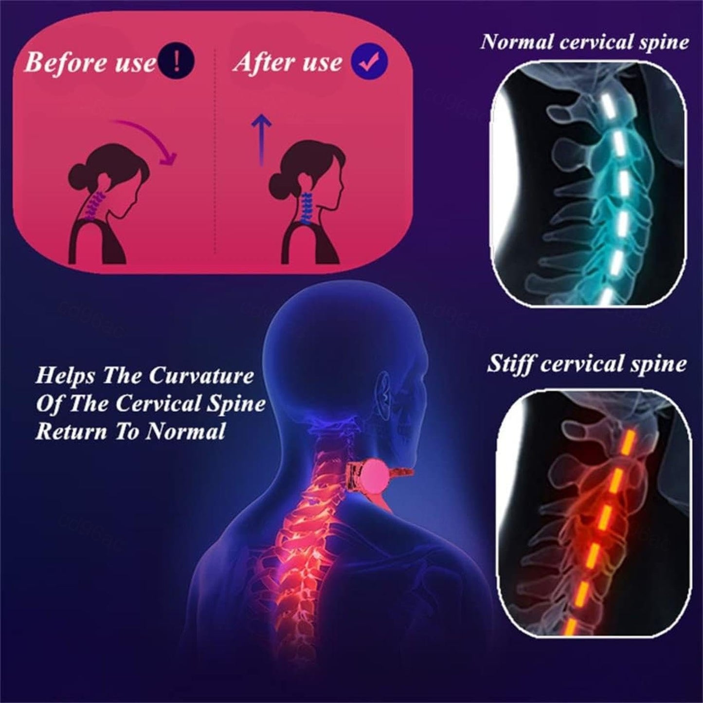 ⏰Sumer Sale 67%OFF🏆Neck Posture Corrector