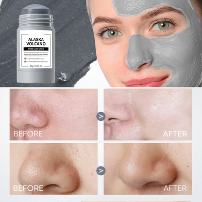 Alaska Volcano Reduce Blackheads Deep Pores Clay Mask