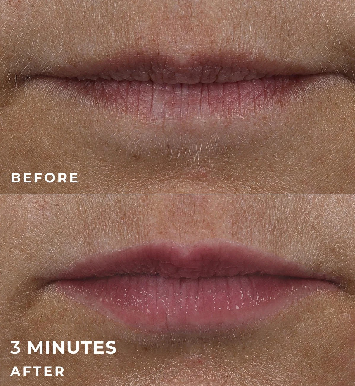 Correxion Lip Volumizer 