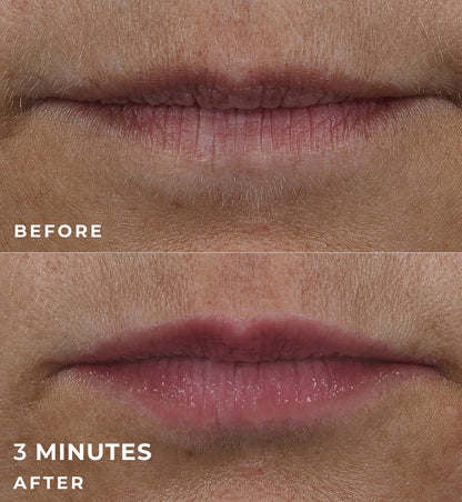 Correxion Lip Volumizer 