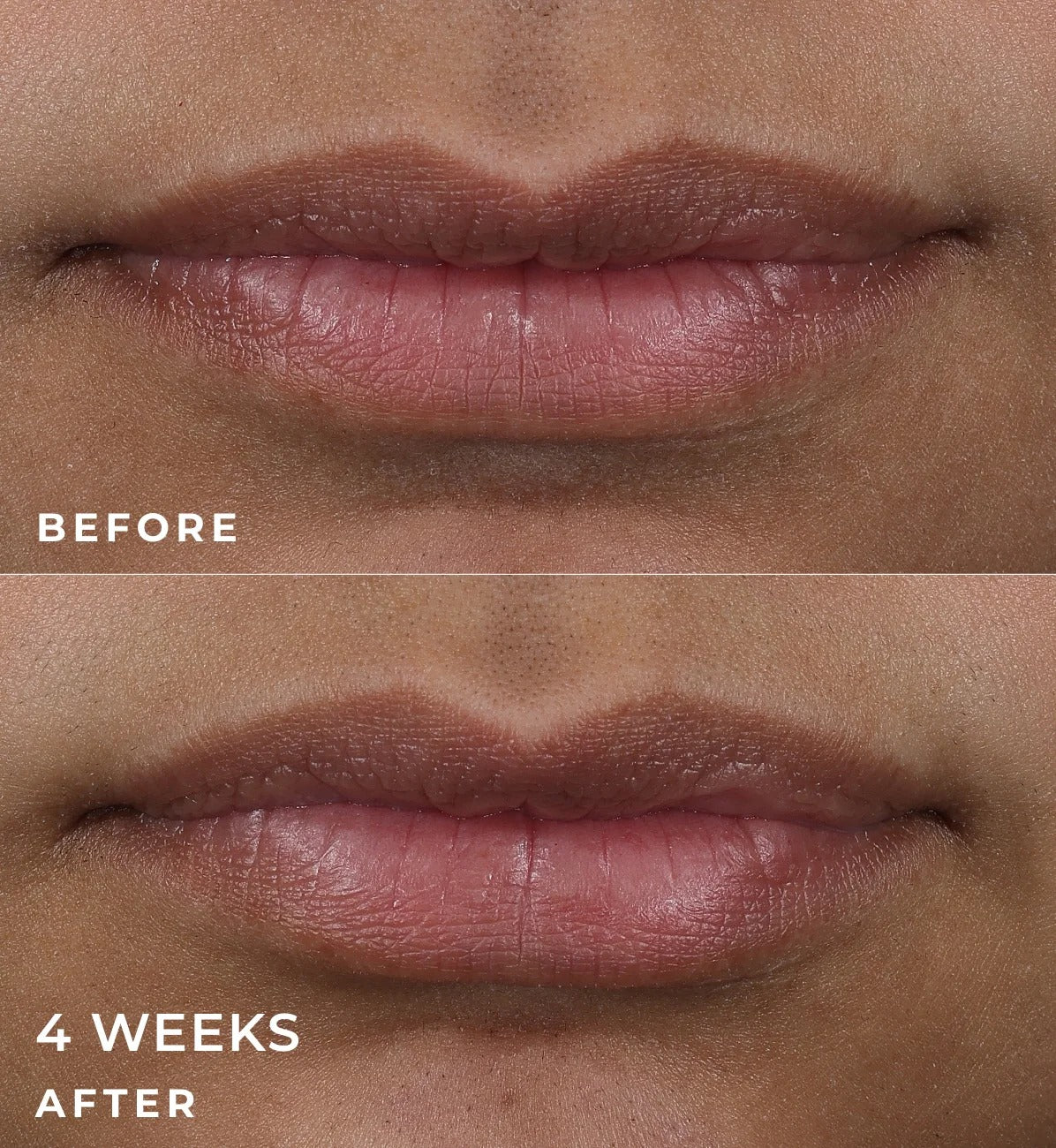 Correxion Lip Volumizer 