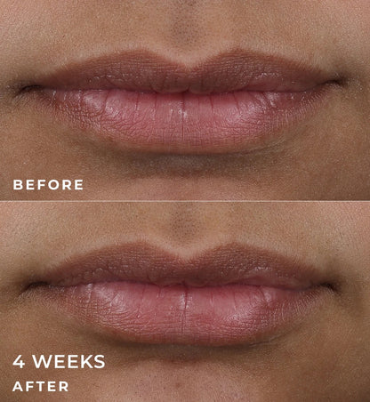 Correxion Lip Volumizer 