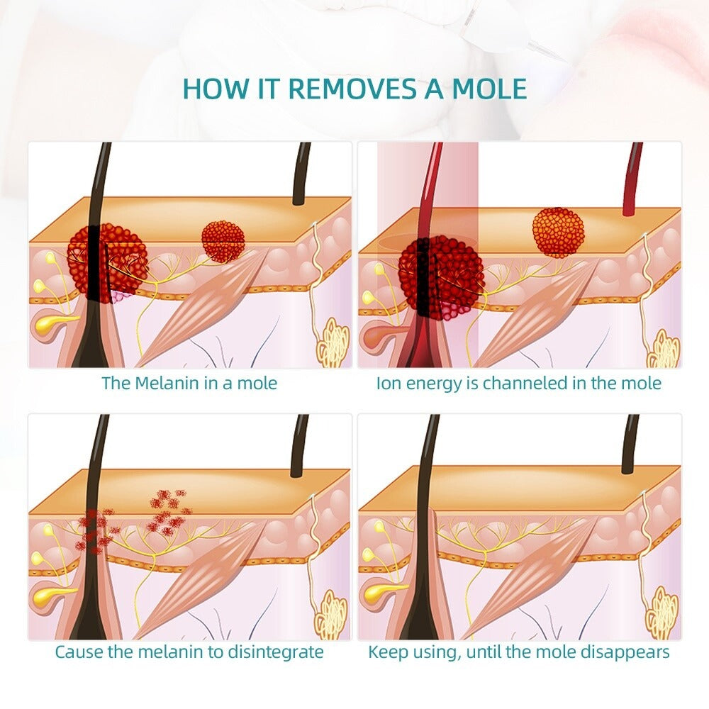 9 Level Laser Plasma Pen 