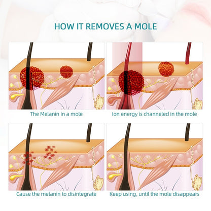 9 Level Laser Plasma Pen 