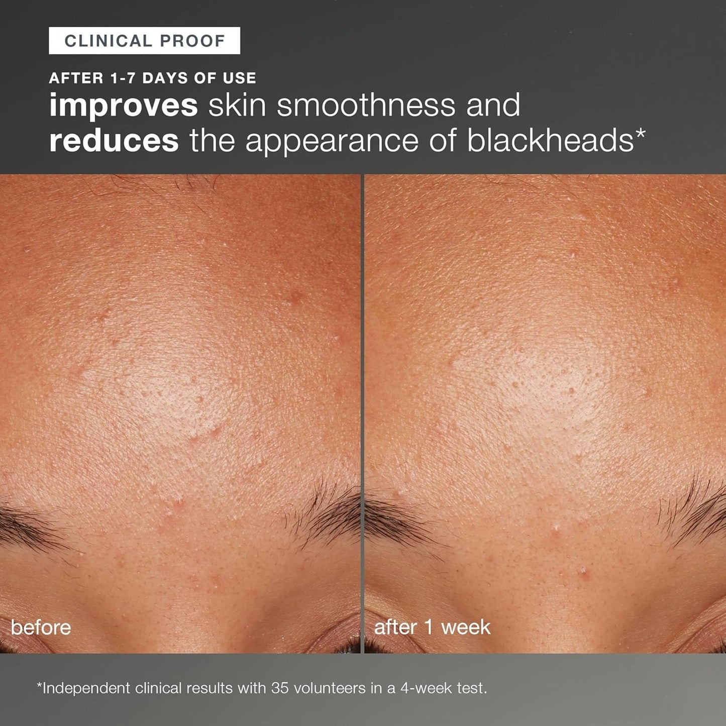 Daily Microfoliant, FaceExfoliator Scrub Powder with SalicylicAcid and Papaya Enzyme, AchieveBrighter, Smoother Skin Daily