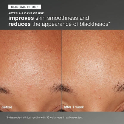 Daily Microfoliant, FaceExfoliator Scrub Powder with SalicylicAcid and Papaya Enzyme, AchieveBrighter, Smoother Skin Daily