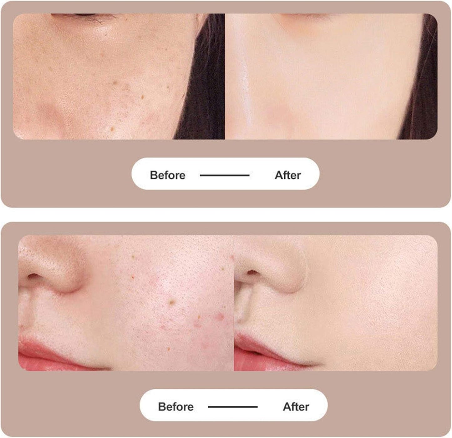 9 Level Laser Plasma Pen 