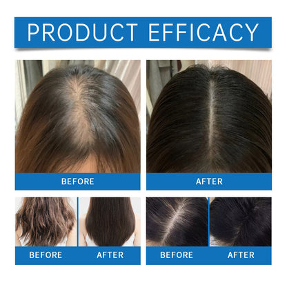  Hair Growth Serum for Hair Loss 