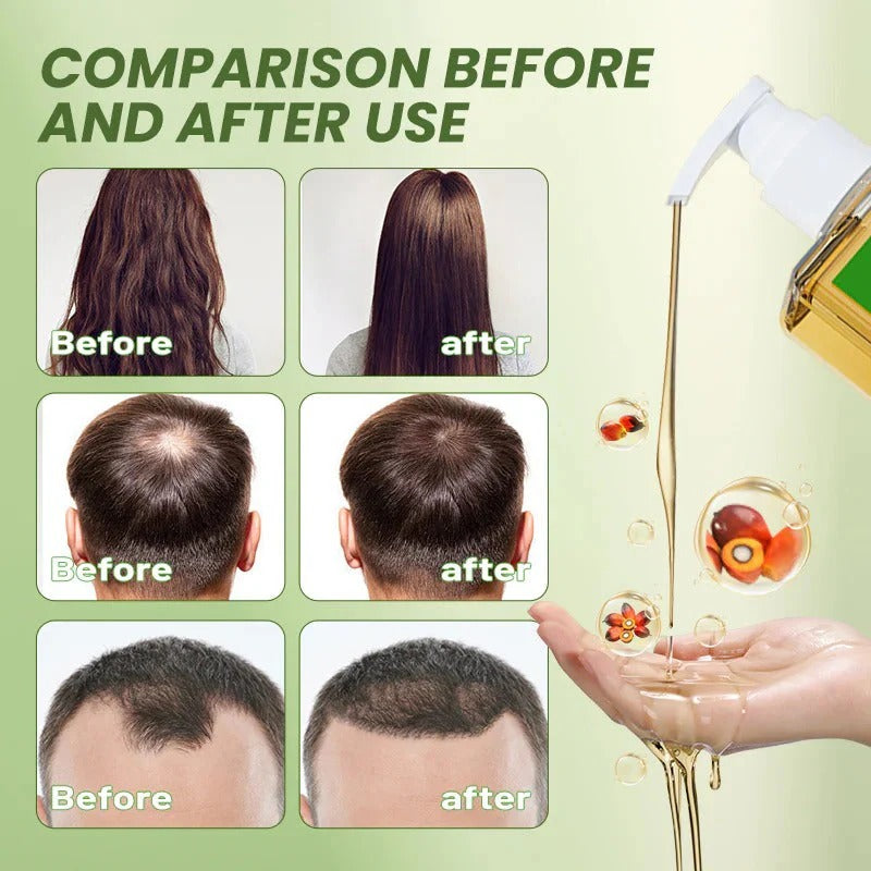 Batana Oil Shampoo- Transform Your Hair From Root to Tip!