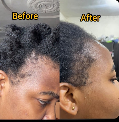 Batana Natural Hair Growth Oil